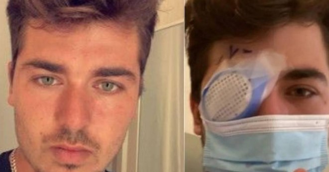 Joven quedó ciego por dormir una siesta con lentes puestos