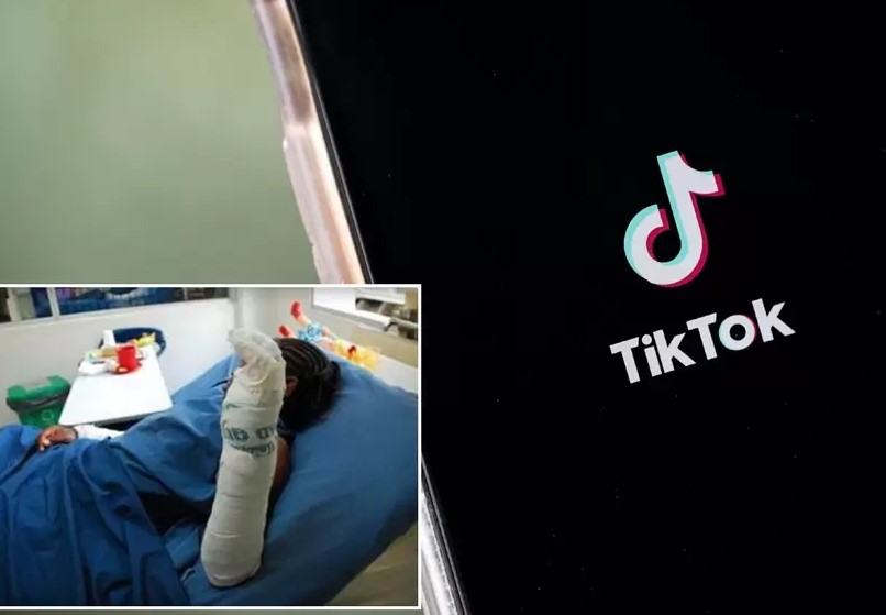 Niño terminó gravemente quemado por hacer reto de TikTok