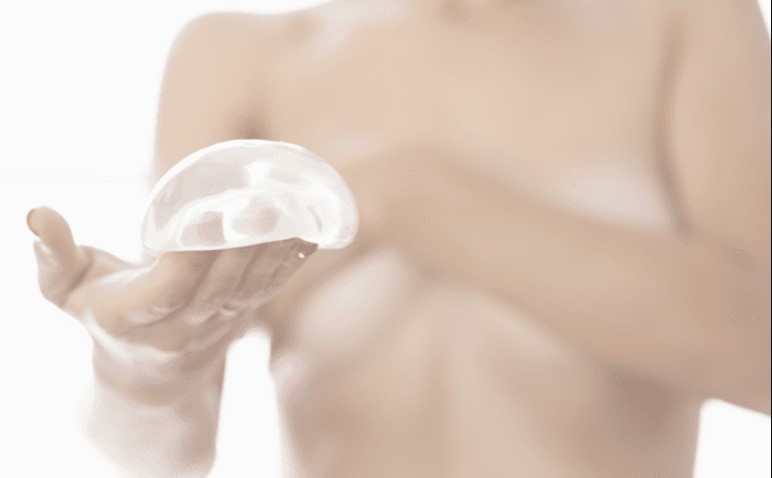¿Son los implantes mamarios la causa del Síndrome de Asia? Expertos explican las imprecisiones