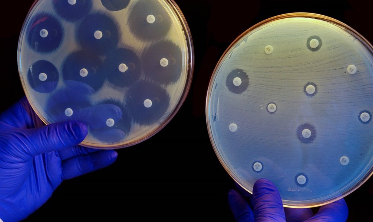 ¿Por qué las bacterias se hacen resistentes a los antibióticos?