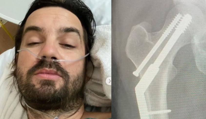 Kevin Parker de Tame Impala se fracturó la cadera a días del Estéreo Picnic 2023