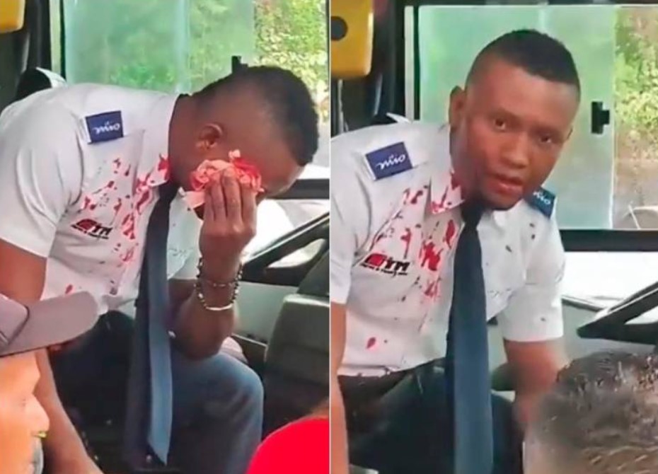 Grave agresión a conductor del MIO en Cali por reclamo de velocidad