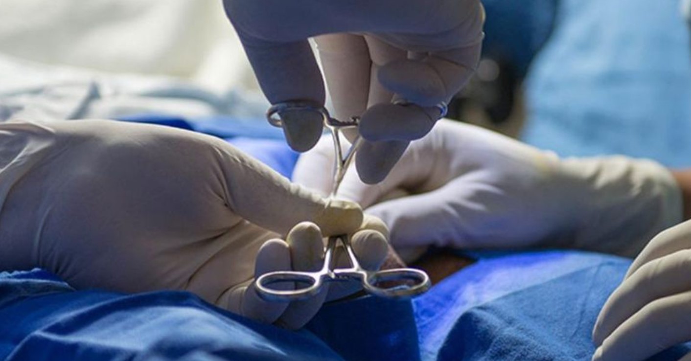 Por hacer mal una vasectomía, médico deberá ayudar a criar hija de su paciente