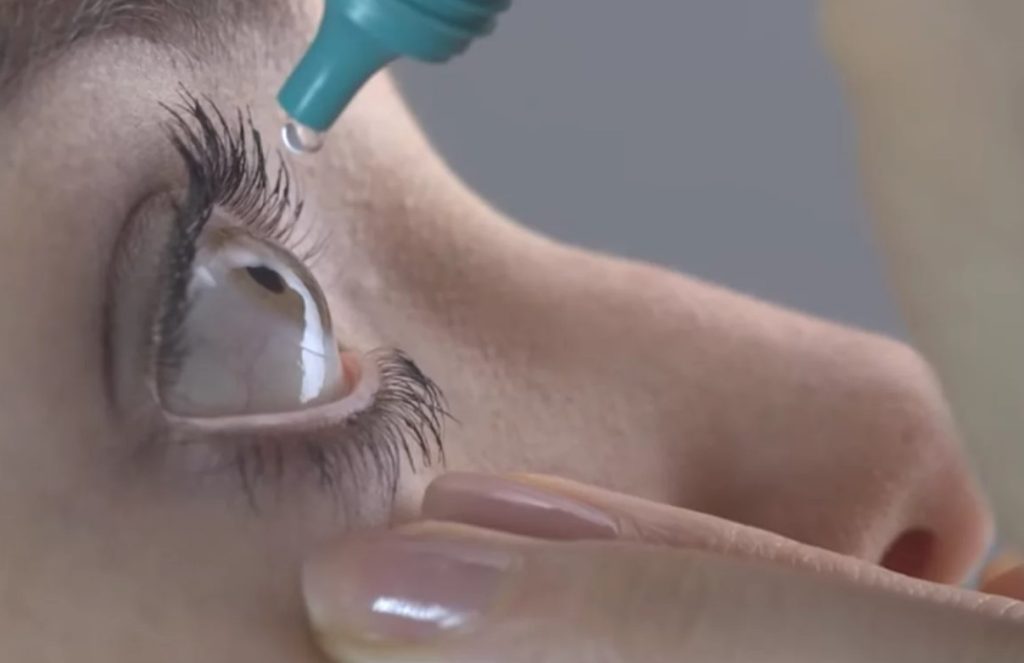 Mujer selló sus ojos con pegamento al creer que eran gotas refrescantes