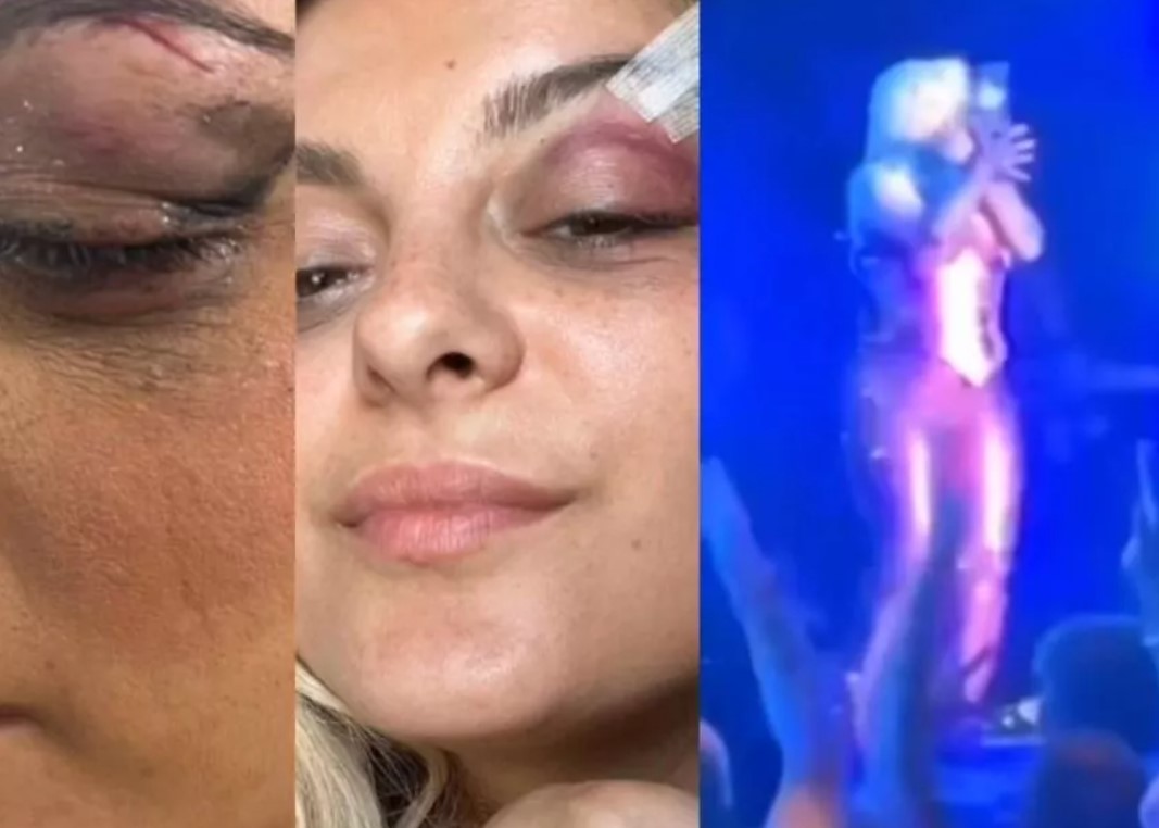 Por cumplir un reto de tiktok fanático lanzó celular y golpeó a cantante en el rostro