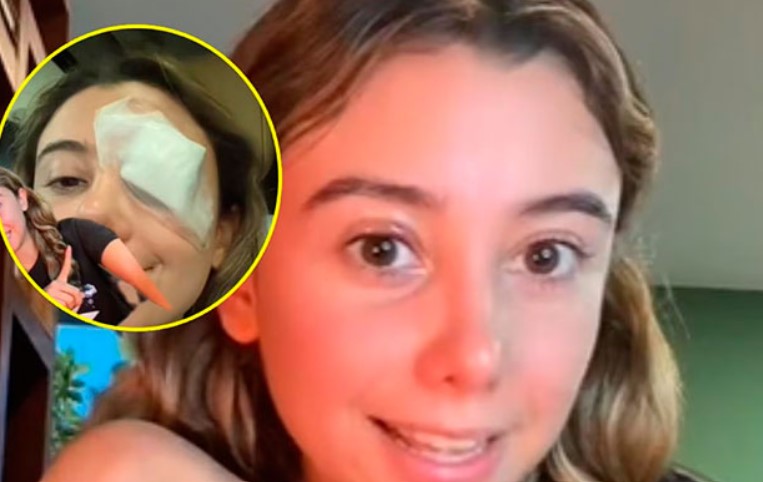 Joven terminó en el quirófano cuando falló truco de maquillaje que vio en TikTok