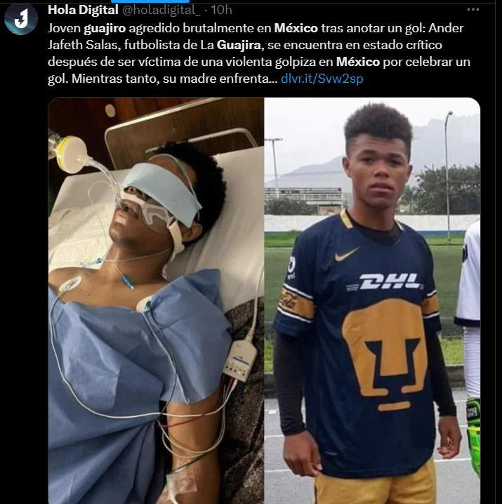Colombiano en coma tras brutal golpiza por festejar gol en partido en México
