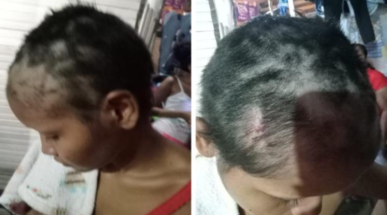 Brutal agresión a mujer por parte de su pareja en Valledupar