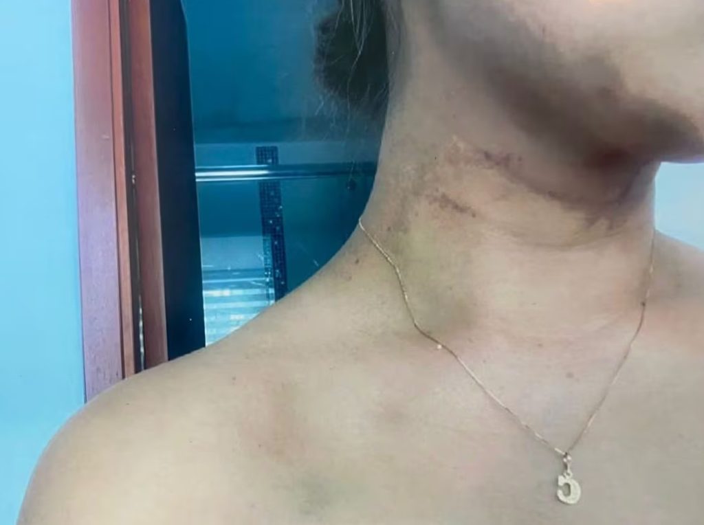 Mujer espera justicia tras sufrir violento ataque por parte de su pareja