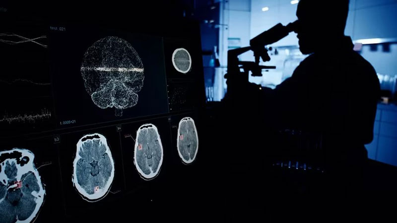 Análisis para la detección temprana del Alzheimer Foto: elonce