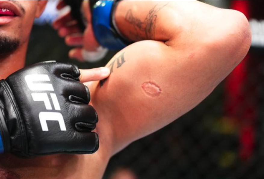 Pelea de UFC termina en descalificación por mordida