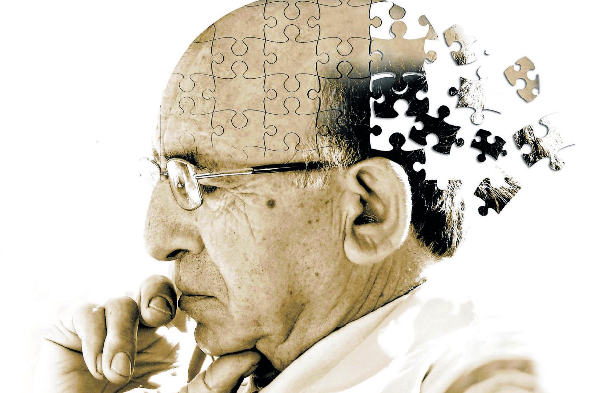 Avances en la lucha contra el Alzheimer: un nuevo estudio revela progreso prometedor