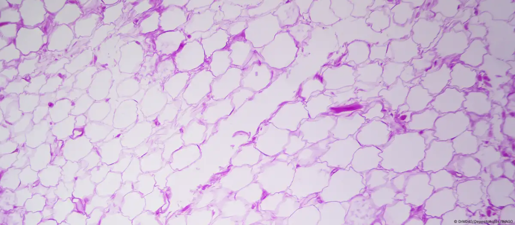 Bajo la piel: tejido adiposo de la hipodermis a gran aumento Foto: DrWD40/Depositphotos/IMAGO