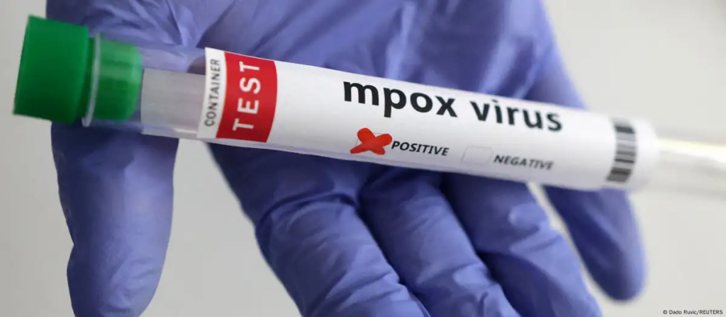 Test de mpox o viruela símica. Imagen: Dado Ruvic/REUTERS