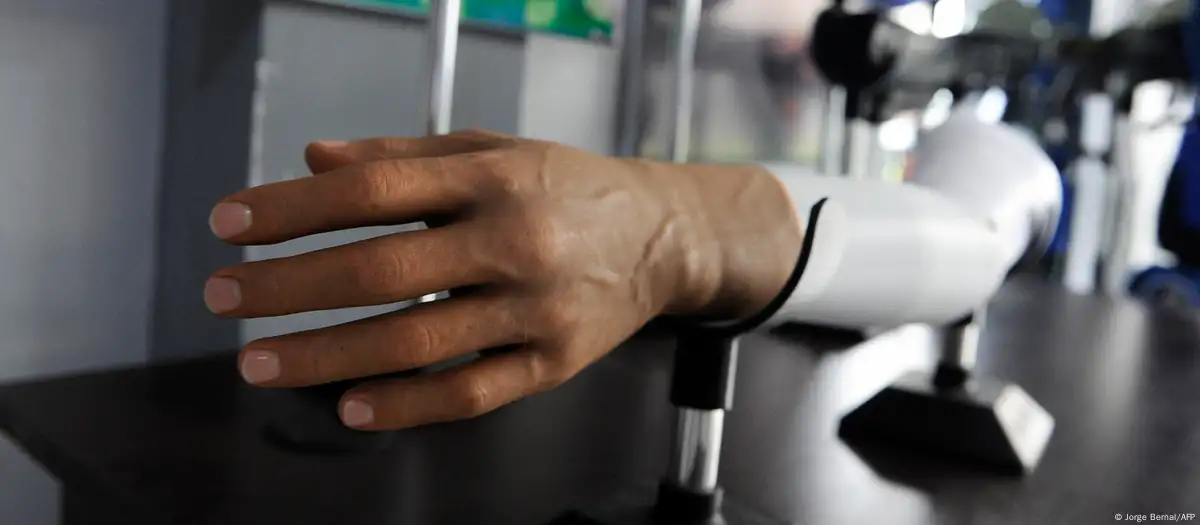 Una mano robótica. Foto: Jorge Bernal/AFP