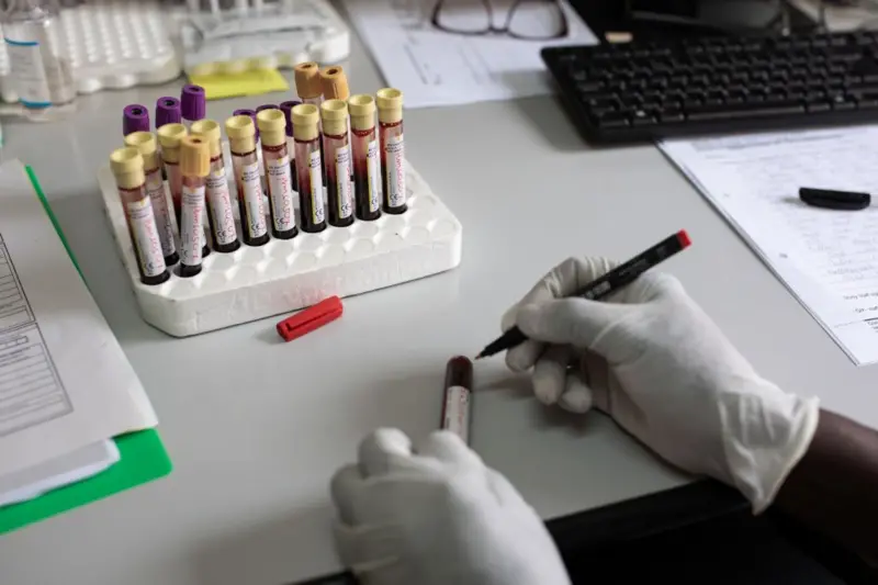 El lenacapavir se convierte en el primer tratamiento preventivo de acción prolongada aprobado por la FDA Foto: Getty Images