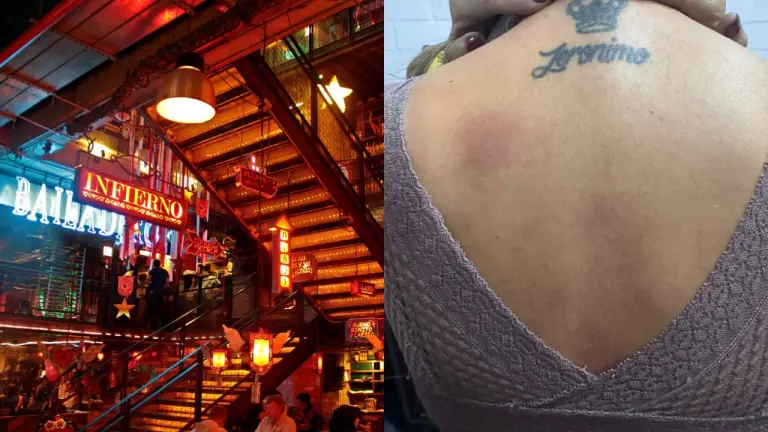 Personas resultaron quemadas en Andrés DC en Bogotá Foto: Andrés y suministrada vía bluradio