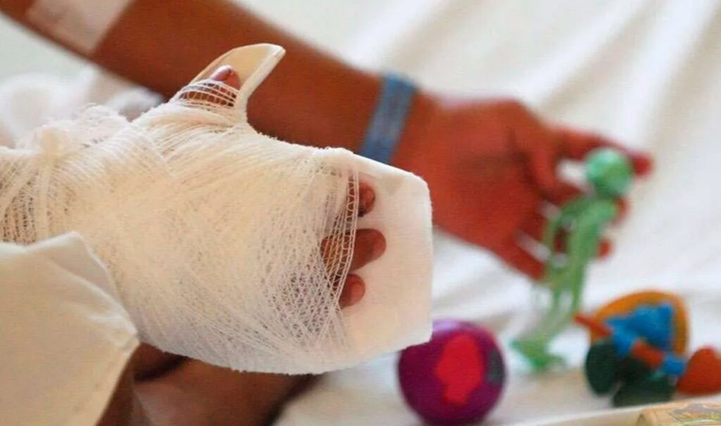 86 menores de edad resultaron quemados con pólvora en la noche de velitas