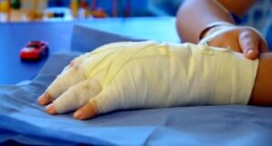 Colombia cerró temporada navideña 2025 con más de mil quemados por pólvora